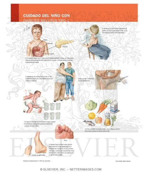 Watermarked preview of labeled image: Caring for Your Child With Diabetes Mellitus Type 1