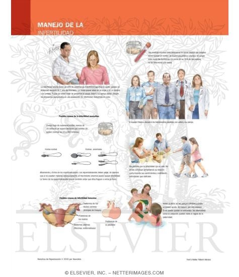 Watermarked preview of labeled image: Understanding Infertility