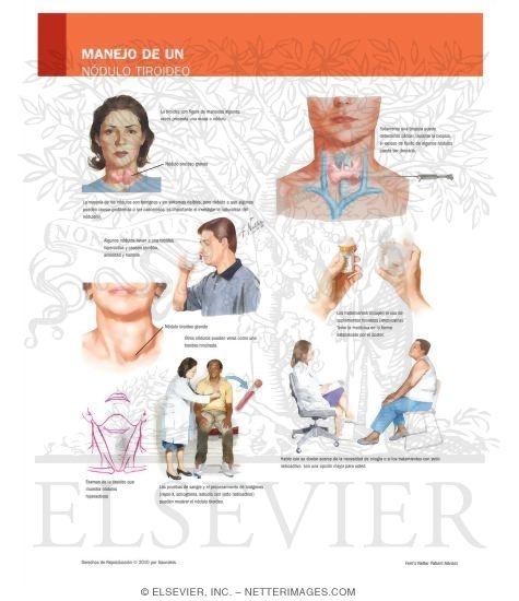 Managing Your Thyroid Nodule