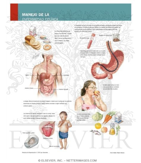 Managing Celiac Disease