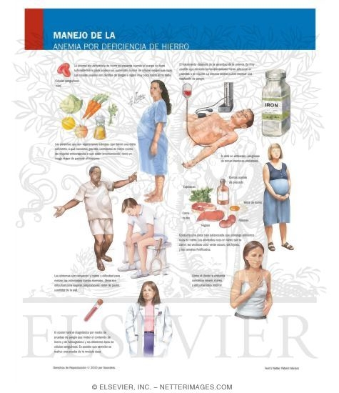 Managing Your Iron Deficiency Anemia