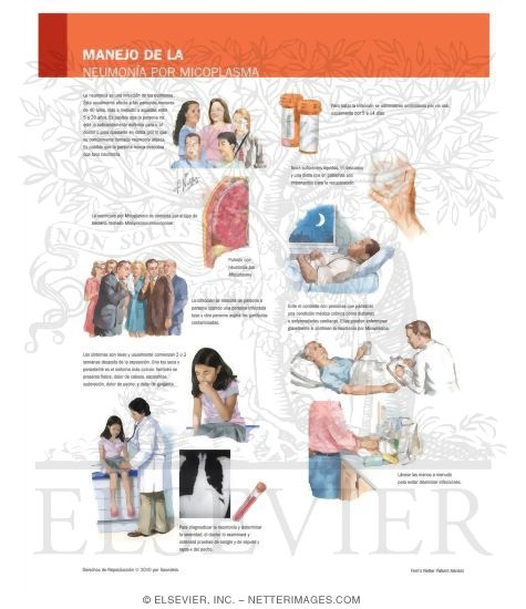 Watermarked preview of labeled image: Managing Your Mycoplasma Pneumonia