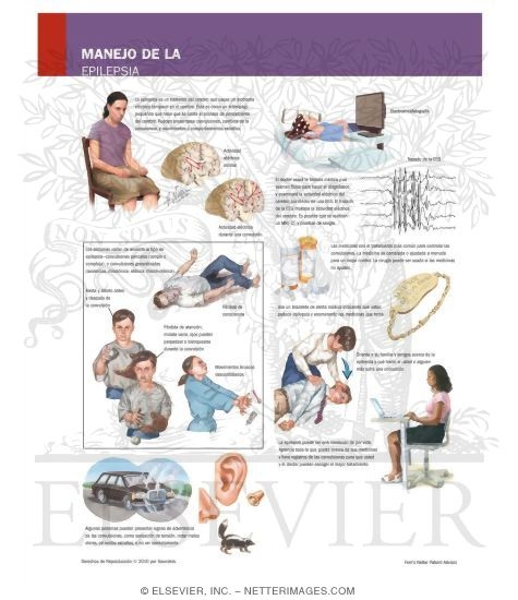 Watermarked preview of labeled image: Managing Your Epilepsy