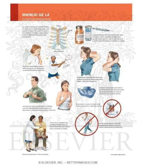 Managing Your Costochondritis
