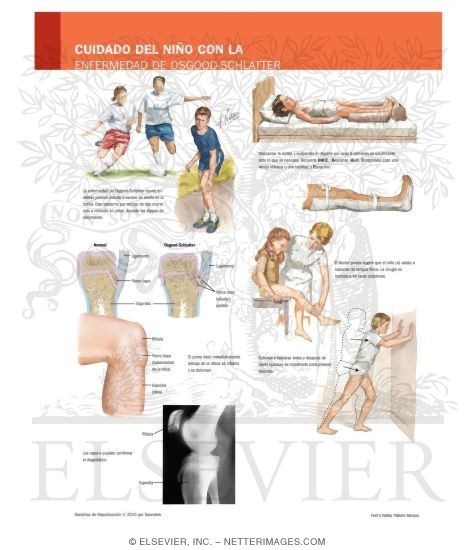 Caring for Your Child With Osgood-Schlatter Disease