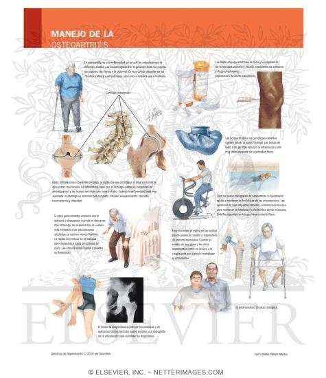 Watermarked preview of labeled image: Managing Your Osteoarthritis