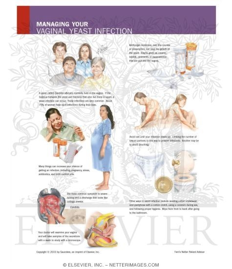 Watermarked preview of unlabeled image: Managing Your Vaginal Yeast Infection