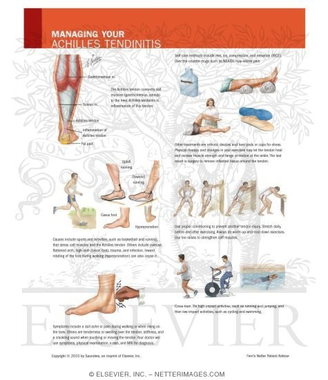 Watermarked preview of unlabeled image: Managing Your Achilles Tendinitis