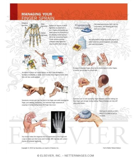 Watermarked preview of unlabeled image: Managing Your Finger Sprain