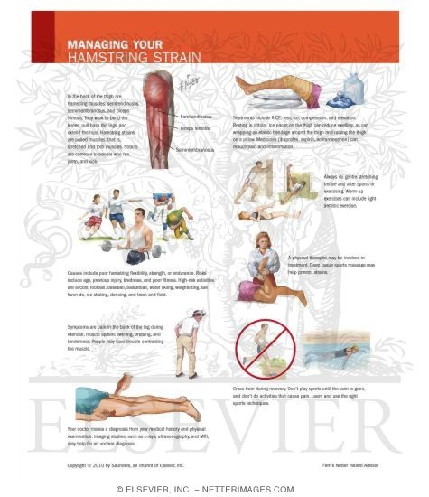 Watermarked preview of unlabeled image: Managing Your Hamstring Strain
