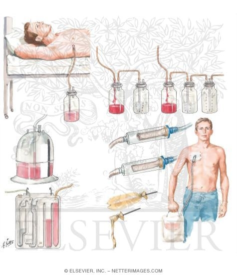 Chest Draining Methods
