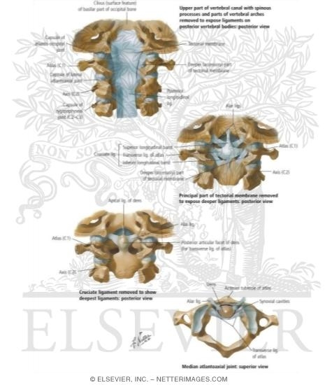 Watermarked preview of labeled image: Internal Craniocervical Ligaments