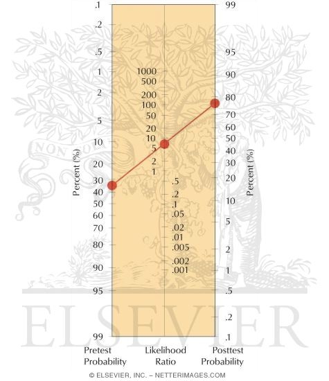Watermarked preview of labeled image: Cluster of Tests for Sacroiliac Dysfunction After the McKenzie Evaluation to Rule Out Discogenic Pain