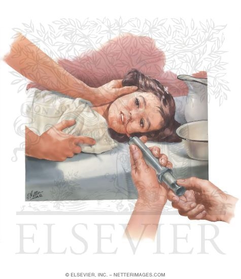 Watermarked preview of unlabeled image: Accidental Poisoning In Children