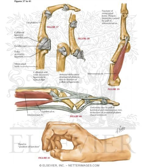 Watermarked preview of labeled image: Surgical Anatomy of the Hand