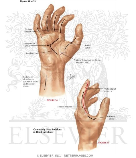 Watermarked preview of labeled image: Surgical Anatomy of the Hand
