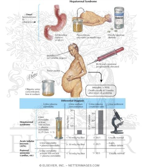 Hepatorenal Syndrome