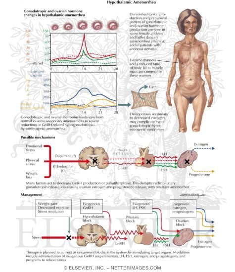 Watermarked preview of labeled image: Current Perspectives In Gynecology: Hypothalmic Amenorrhea