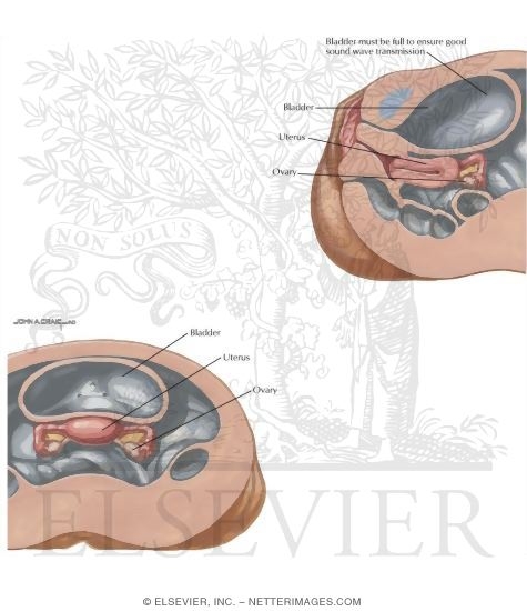 Watermarked preview of labeled image: Current Perspectives In Gynecology: Real-Time Pelvic Ultrasonography