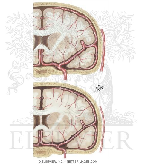 Watermarked preview of unlabeled image: Vascular Theory Migraine: Etiology