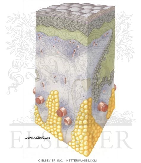 Watermarked preview of unlabeled image: Conversion of Partial Thickness Injury to Full Thickness Injury By Infection