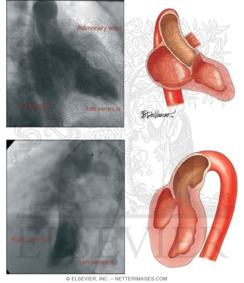 Watermarked preview of unlabeled image: Contrast Injection