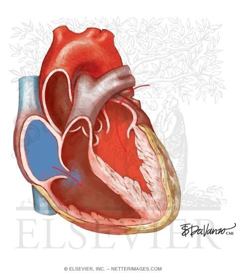 Watermarked preview of unlabeled image: Summary of Doppler Findings In Restrictive Cardiomyopathy