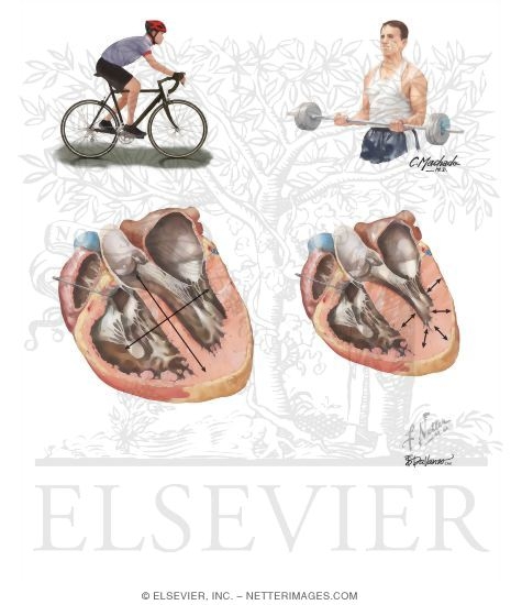 Watermarked preview of unlabeled image: Left Ventricular Hypertrophy Resulting From Aerobic Training