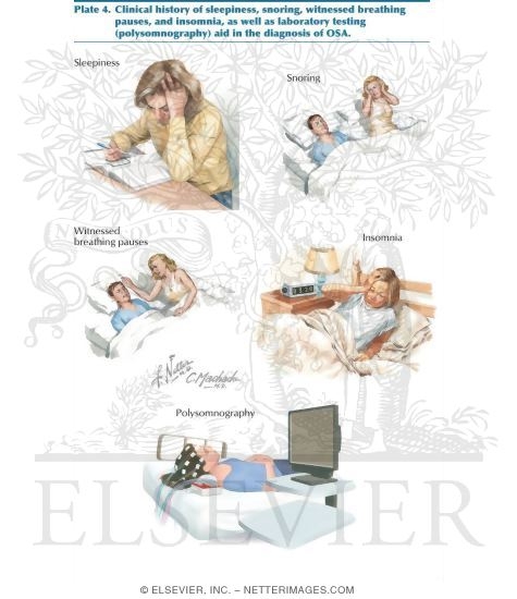 Watermarked preview of labeled image: Clinical History for Obstructive Sleep Apnea