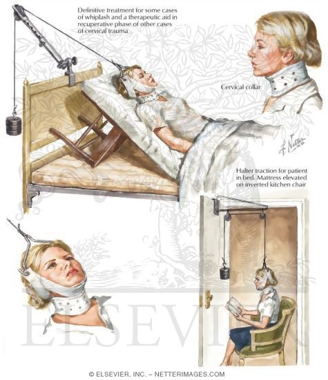 Watermarked preview of labeled image: Home Treatment for Cervical Injuries
