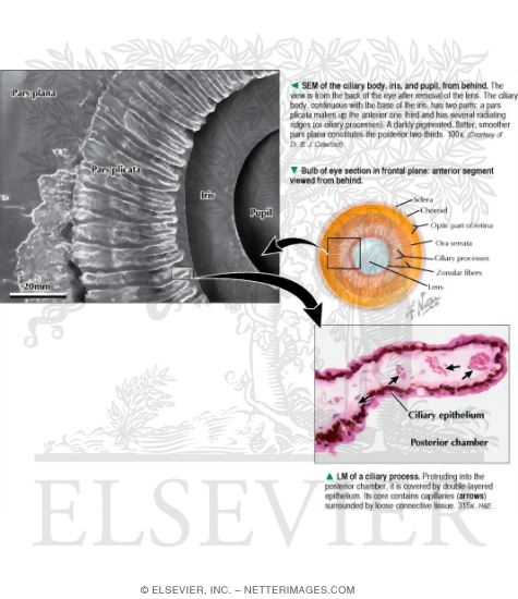 Watermarked preview of labeled image: Anterior Segment Viewed From Behind