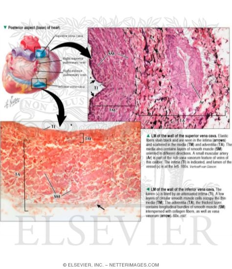 Posterior Aspect (base) of Heart With Light Micrograph of the Wall of the Superior Vena Cava And Light Micrograph of the Wall of the Inferior Vena Cava