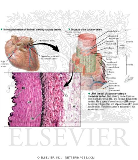 Sternocostal Surface of the Heart Showing Coronary Vessels and Structure of the Coronary Artery With Light Micrograph of the Wall of a Coronary Artery In Transverse Section