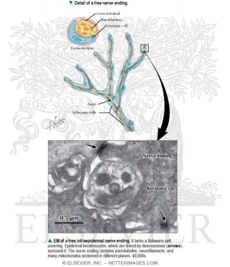 Watermarked preview of labeled image: Electron Micrograph of a Free Intraepidermal Nerve Ending