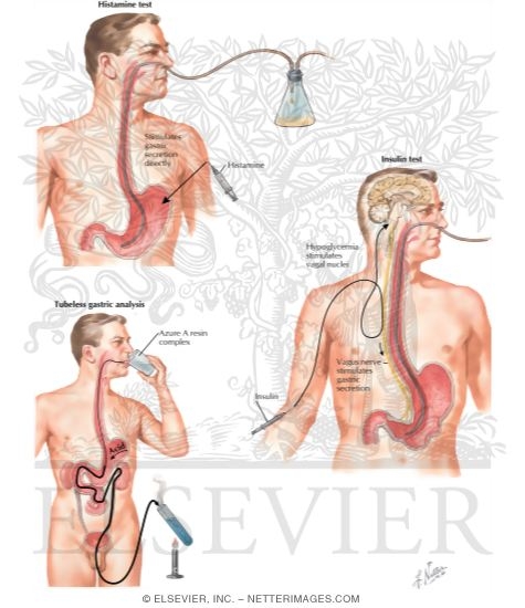 Gastric Analysis