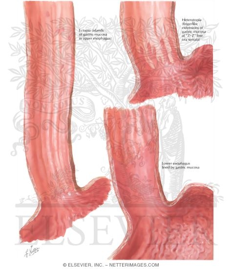 Watermarked preview of labeled image: Congenital Anomalies