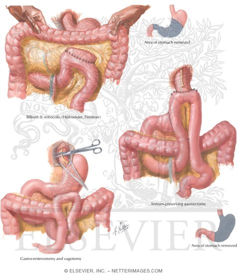 Watermarked preview of labeled image: Principles of Operative Procedures