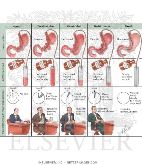 Watermarked preview of labeled image: Functional Changes in Gastric Diseases