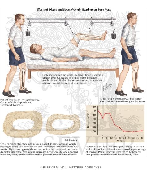 Watermarked preview of labeled image: Effects of Disuse and Stress (Weight Bearing) on Bone Mass