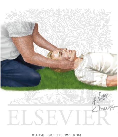 Watermarked preview of labeled image: Skull Traction