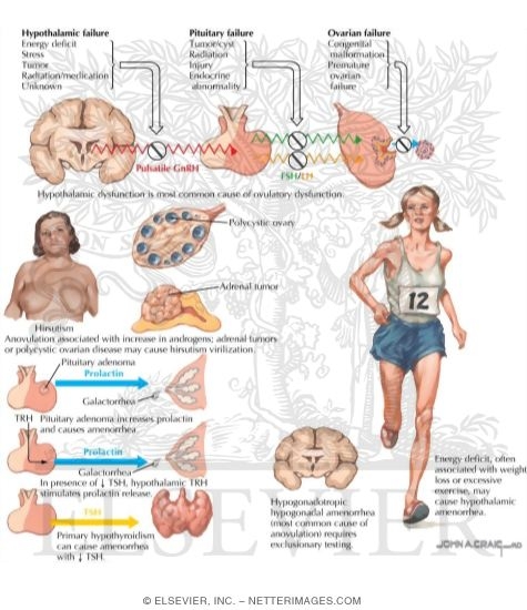 Causes of Ovulatory Dysfunction