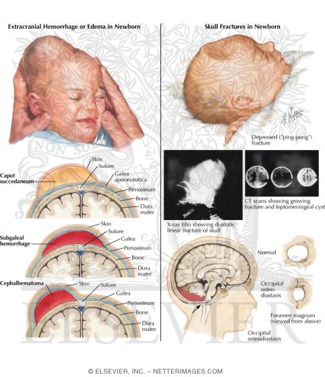 Action of Drugs on Nerve Excitability