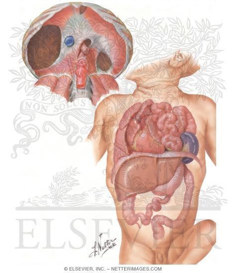 Diaphragmatic Hernia
