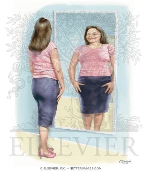 Distorted Body Image
