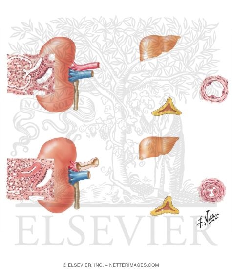 Renovascular Hypertension