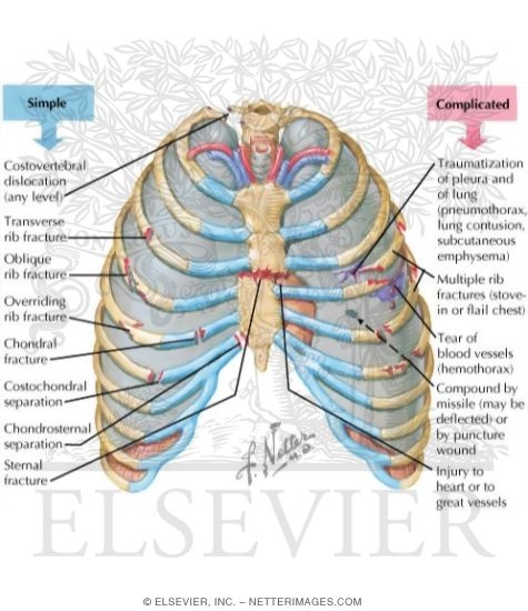 thoracic cage diagram labeled