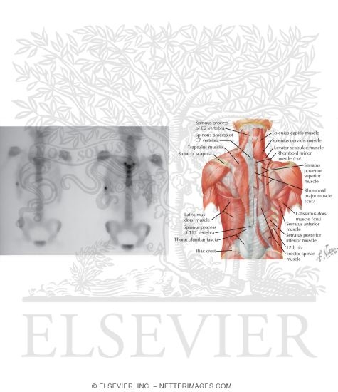 Muscles of Back: Superficial Layers
Superficial Muscles: Posterior Neck and Back