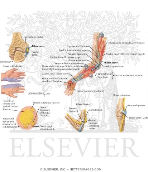Compression of Ulnar Nerve