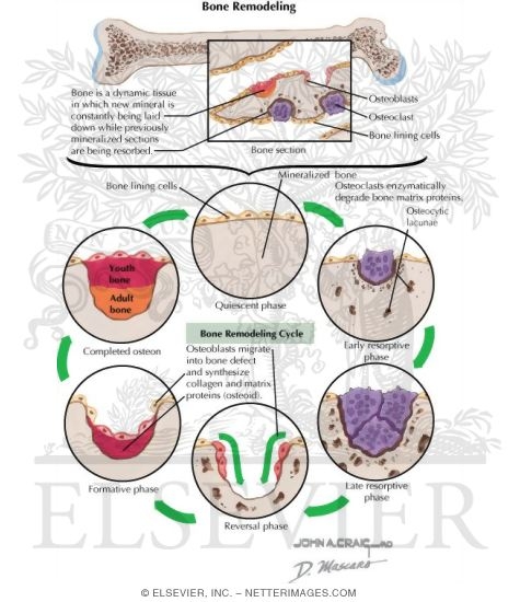 Watermarked preview of labeled image: Bone Remodeling Unit