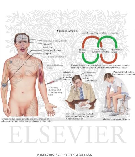 Watermarked preview of labeled image: Chronic Fatigue Syndrome